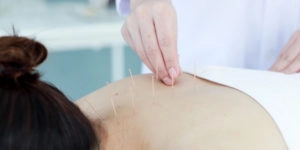 acupuncture what is it and how can you benefit