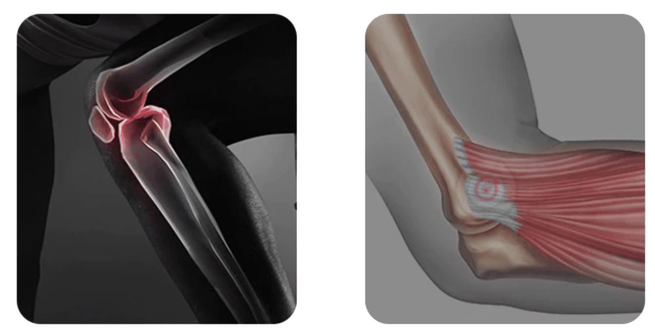 patella stabiliser brace ligament support