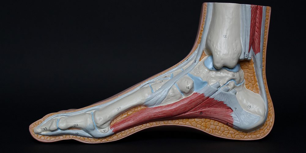 achilles tendinitis what you should know