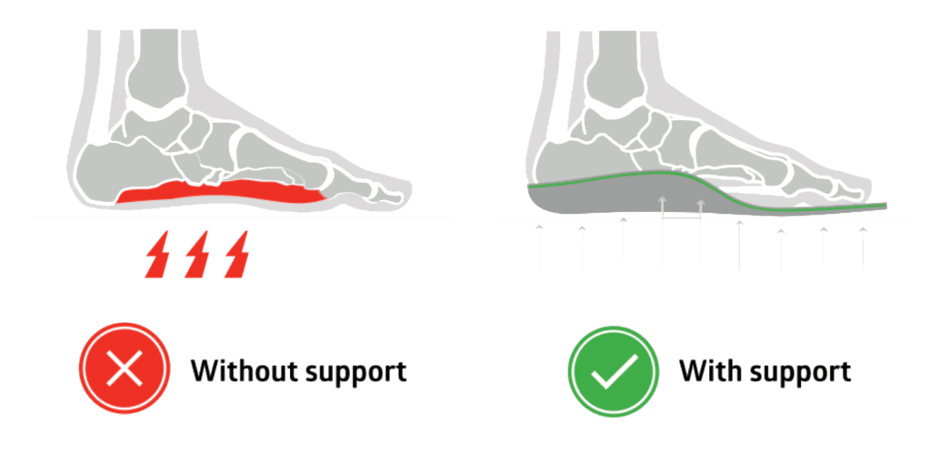 flat feet difference with supportive insoles