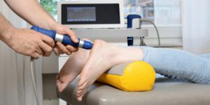 shockwave therapy for plantar fasciitis